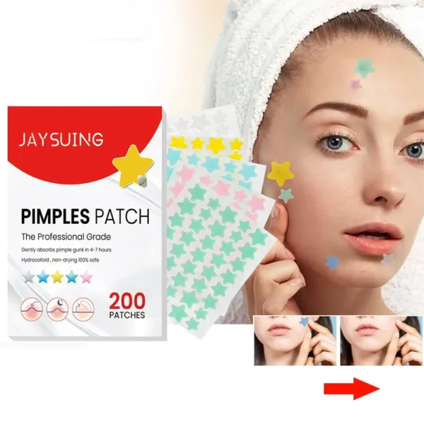 200pcs Star Pimple Patch Acne Colorful Invisible Acne Removal Skin Care Stickers Face Spot Beauty Makeup Tool