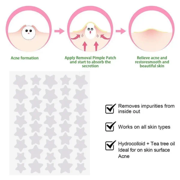 40pcs/Sheet Invisible Acne Pimple Patch Professional Face Skin Care Repair Acne Healing Absorbing Spot Sticker For Men Women - Image 5