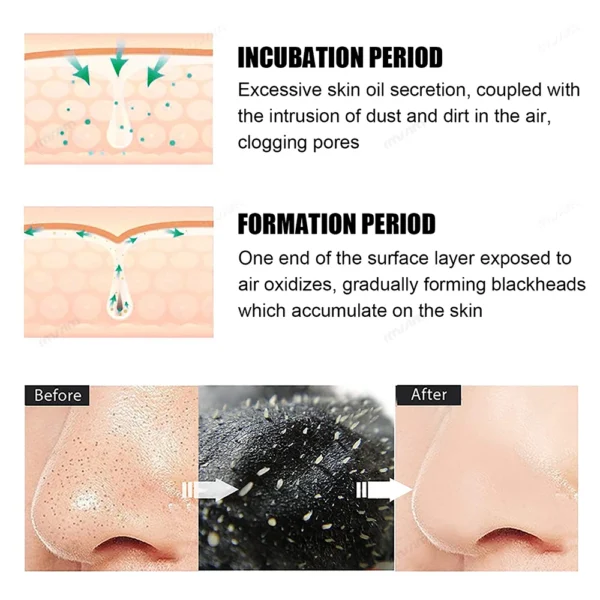 Unisex Deep Cleansing Nose Strips for Acne & Blackhead Removal Shrink Pore Nose Black Head Stickers Skin Care Patch - Image 3